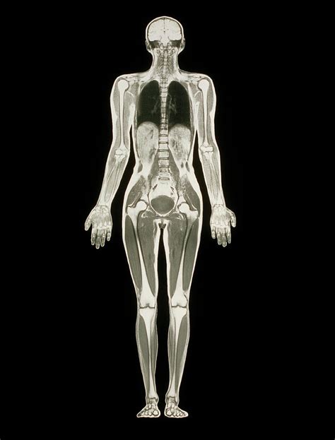 Browse 115 full body mri scan stock photos and images available, or search for full body scan to find more great stock photos and pictures. . Full body scan images female
